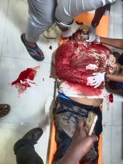 கிரீம்ஸ் ரோட்டில் உள்ள அப்போலோ மருத்துவமனையில்