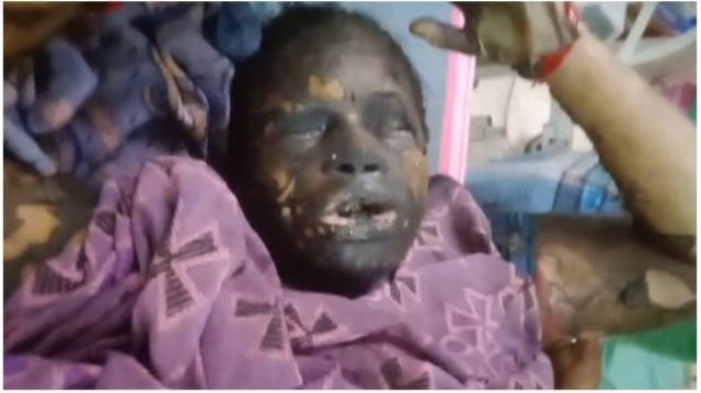 தீக்குளித்து தற்கொலை