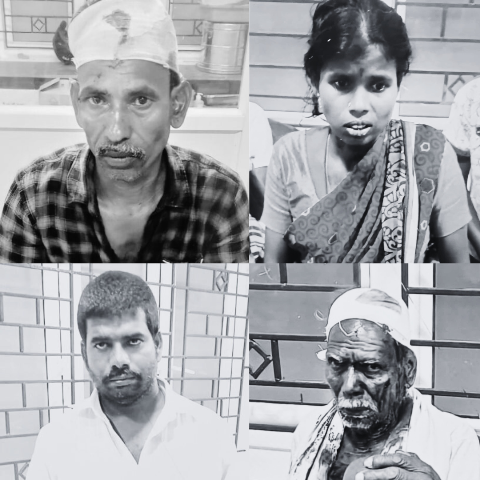 நாய் கடி